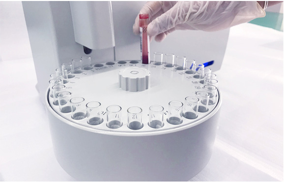 AC9X03 color touch screen interface for electrolyte analyzer operation